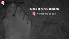 Checking Your Feet For Signs of Nerve Damage