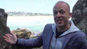 Hair Transplant Sydney | Paul's Progess 12 Weeks Time-Lapse