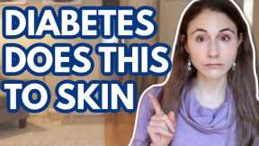 WHAT DIABETES DOES TO YOUR SKIN // DERMATOLOGIST @Dr Dray