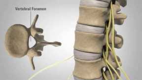 General Back and Neck Pain - Patient Animation