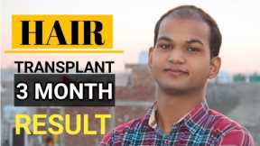 90 Days Hair Regrowth Time Lapse||