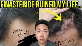 FINASTERIDE RUINED MY LIFE AND HAIR...