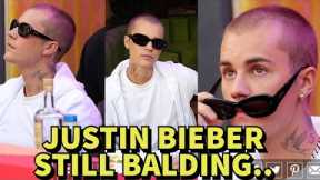 JUSTIN BIEBER IS STILL LOSING HAIR IN 2022.. **PROOF**