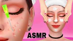 ASMR Acne Removal Skin Care Animation Acne Extraction Pimple Popping