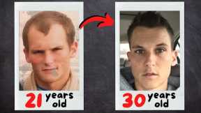 My EPIC Hair-Loss Prevention Journey [Before and After]