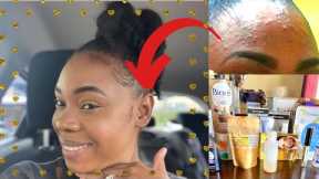 How I Prevent Acne | Skin Care Series 1 | My Daily Skin Routine