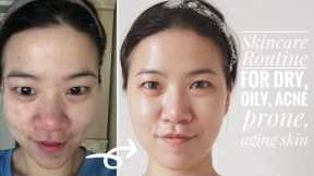 My Skincare Routine | Acne Prone, Dry, Oily & Aging Skin