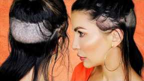 I Got A Hair Transplant | My Emotional Female Hair Transplant Surgery Experience
