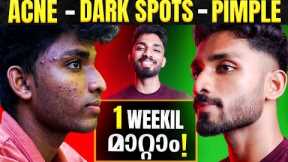 ULTIMATE LOW COST SKIN CARE ROUTINE-GET GLOWING SKIN INSTANTLY|CLEAR YOUR SKIN PROBLEMS IN ONE WEEK