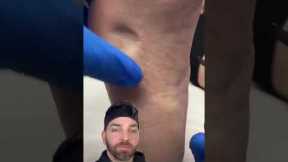 Painful BUMP on the Bottom of the Foot | Doctorly #shorts