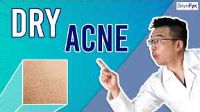 How To Treat Dry Skin + Acne (Dry Acne) | 5 Tips To Follow