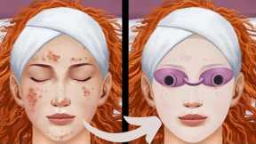 Ultimate Satisfying Acne Blackhead Removal ASMR Animation for Clear Skin Care | #asmr #animation