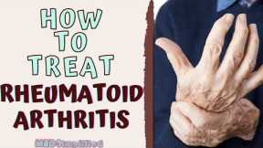 HOW TO TREAT RHEUMATOID ARTHIRITIS. RA Signs and Symptoms and Management.