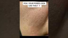 Do you PORES LOOK THIS LARGE?!!!! #skincareroutine #skincare