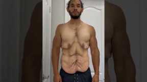 Weight Loss Transformation #SHORTS