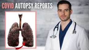 12 COVID Autopsy Cases Reveal the TRUTH HOW COVID PATIENTS DYING