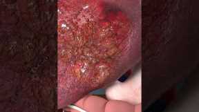 Watch What Happens To Your Body When You Use Steroids