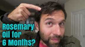 Rosemary Oil for My Hair Loss: Photos Before and After, 6 Month Experiment