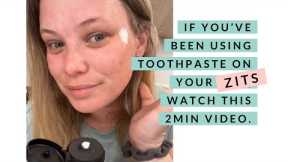 The BEST Spot Treatment for Blemishes Zits Acne Breakouts
