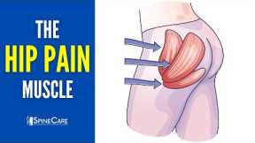 The Hip Pain Muscle (How to Release It for INSTANT RELIEF)