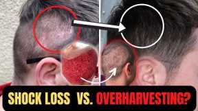 Shock Loss or Overharvesting? How To Spot The Difference