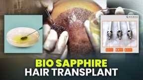 Bio-Sapphire Hair Transplant: What Is It and How Does It Work? 🤔 | New Roots | Kolkata