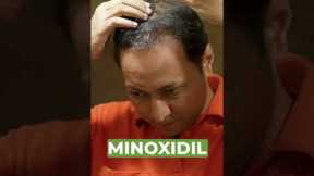 Dr. Agni, Dermatologist explains the real reason why minoxidil causes increased hair fall