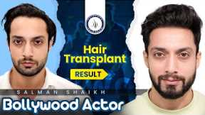 Celebrity Hair Transplants: Salman Shaikh's Results | Hairfree & Hairgrow #hairtransformation