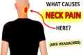 Say Goodbye to Upper Neck Pain with