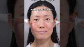 Do you have Dry skin or Oily skin? Anua serums, moisturizer, Dr Althea 345 cream #skincareroutine