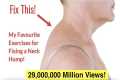 How to Fix a Neck Hump at Home (FAST) 