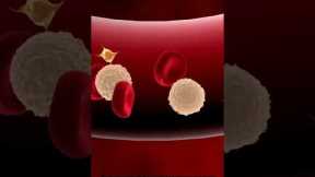 Prevent nerve pain due to Diabetes 5 | Diabetic Neuropathy