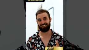 Mr.justin Hair growth time-LAPSE Incredible Result  after  2 years !#greffedecheveux   #hairextrem