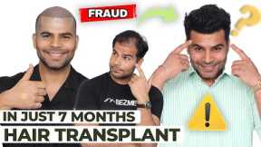 Hair Transplant in Mumbai | Best Results & Cost of Hair Transplant in Mumbai
