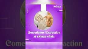 Here's A Quick Way To Solve The Comedones Extraction Problem | Viral #shorts