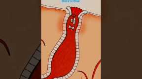 don't Pop your acne 🥶 #skincare #transformation #beauty #acne #skincareroutine #glowupchallenge