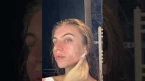 Realistic Skincare Routine For Acne Prone #acne #skincare