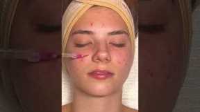 ASMR Relaxing Facial on @katemariess