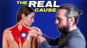 The STRESS MUSCLE Destroying Your Neck, Back & Head