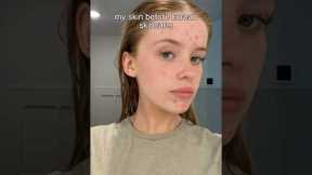 I tried a Korean skincare routine for 3 weeks heres the results so far✨see description 👇🏼😘🫶🏼