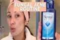 Treat Fungal Acne With This Skincare
